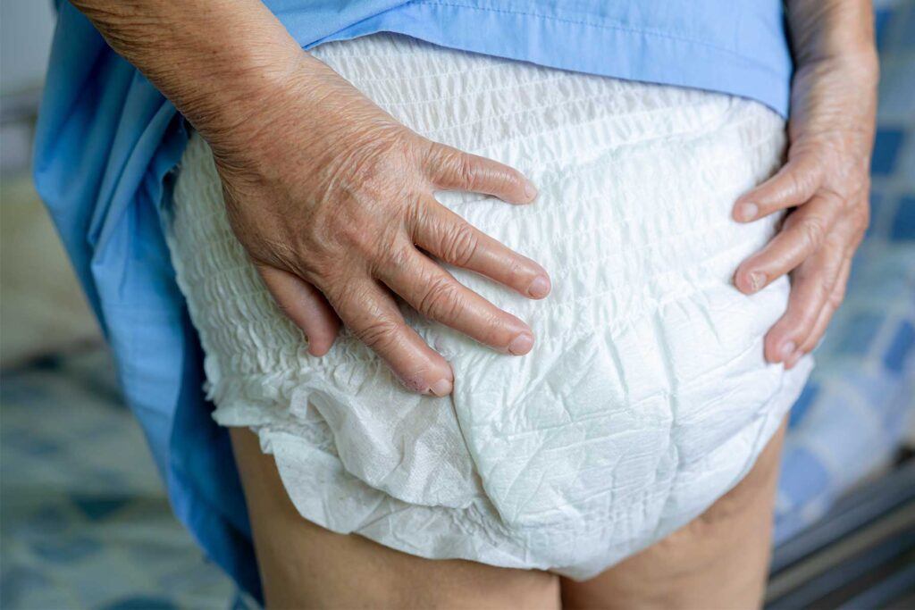 Como cambiar el pañal a una persona mayor encamada