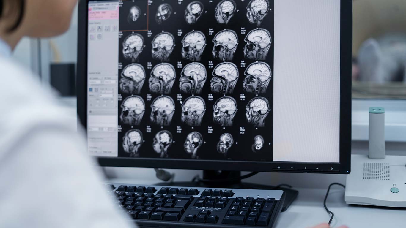 La atención de seguimiento es una parte clave del tratamiento y seguridad.