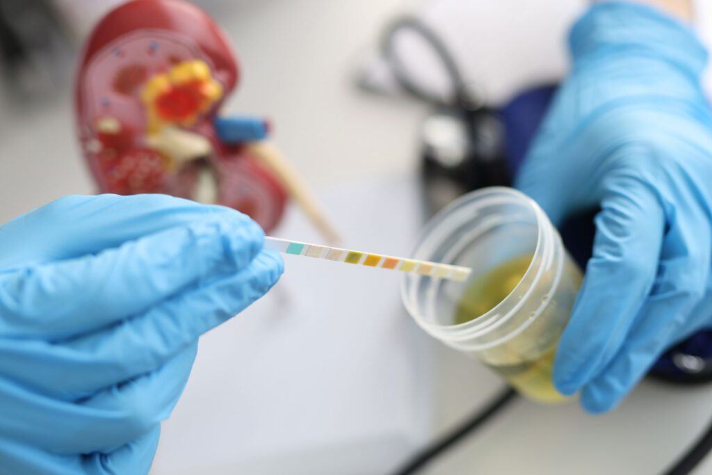 Como recoger orina a personas mayores.