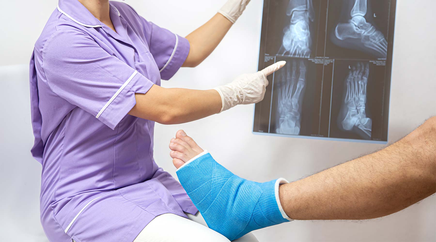 Fractura ósea del pie y la pierna en un paciente masculino que está siendo examinado por una doctora.