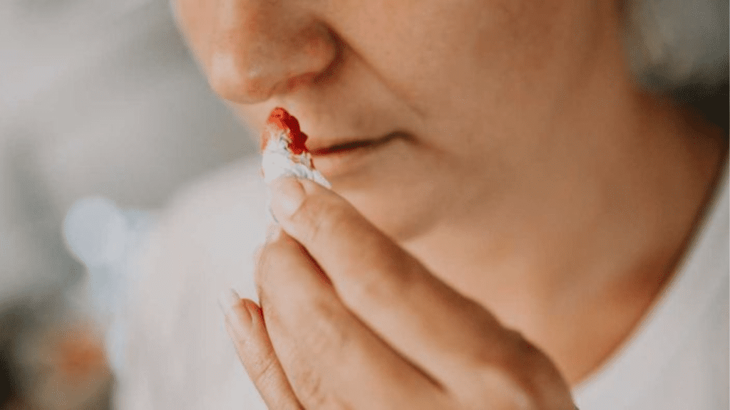 Hemorragias nasales en adultos mayores
