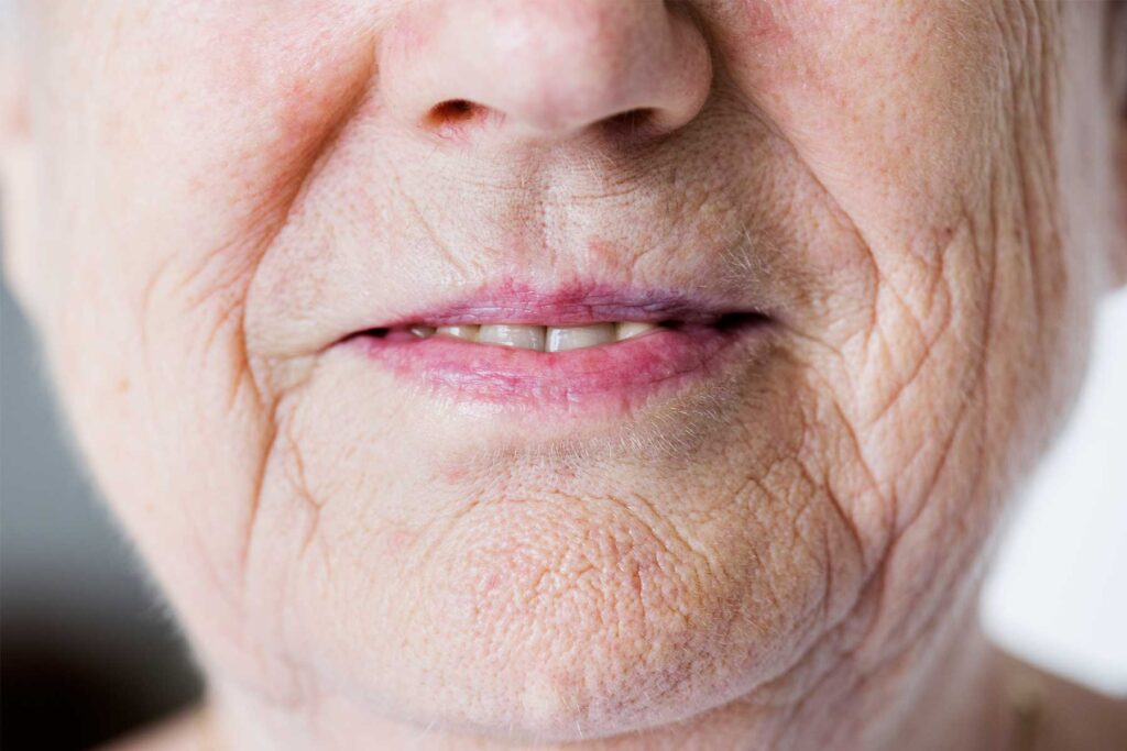 Movimientos involuntarios de la boca en ancianos.