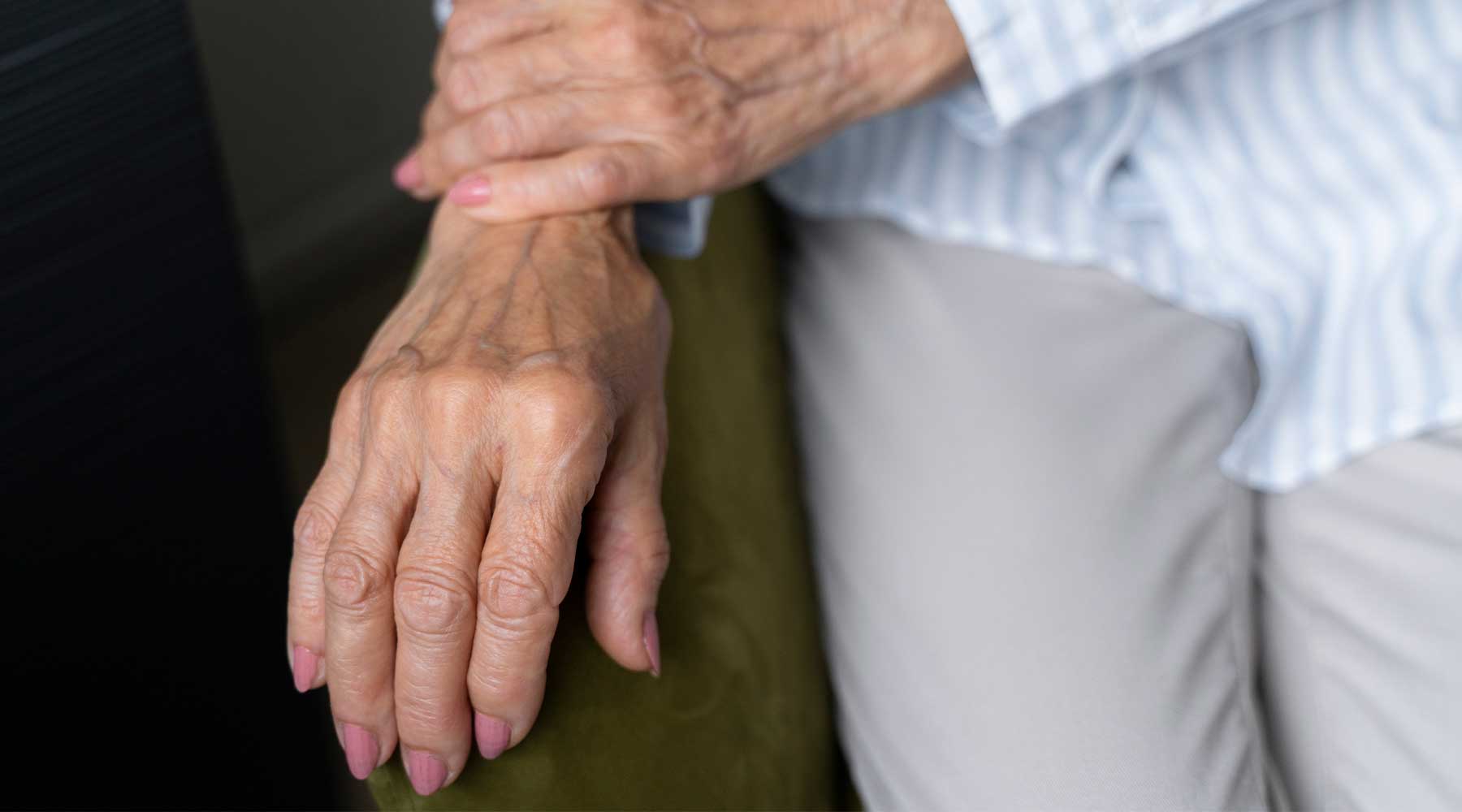 Anciana con manos hinchadas por problemas circulatorios.