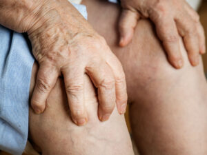 artritis reumatoide en la tercera edad