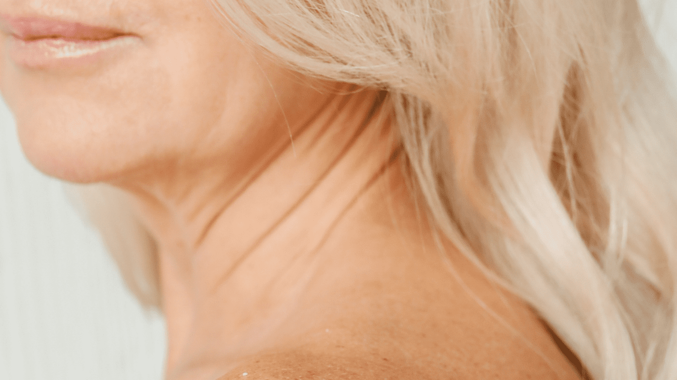 piel amarilla en personas mayores